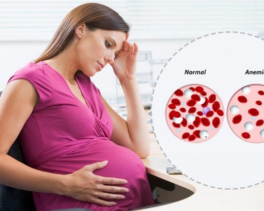 anemia during pregnancy