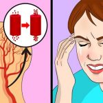 Consuming Salt (Sodium) in Large Amounts Leads to Hypertension (Headaches) Which is a Symptom of High Salt Intake