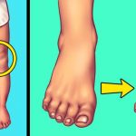 Eating too Much Salt can Lead to Swelling