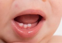baby born with teeth