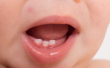 baby born with teeth