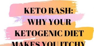 all-you-need-to-know-about-the-keto-rash