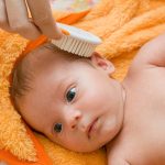 Hair Fall in Babies