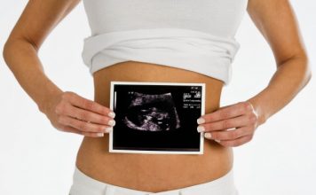 difference between ultrasound and sonogram