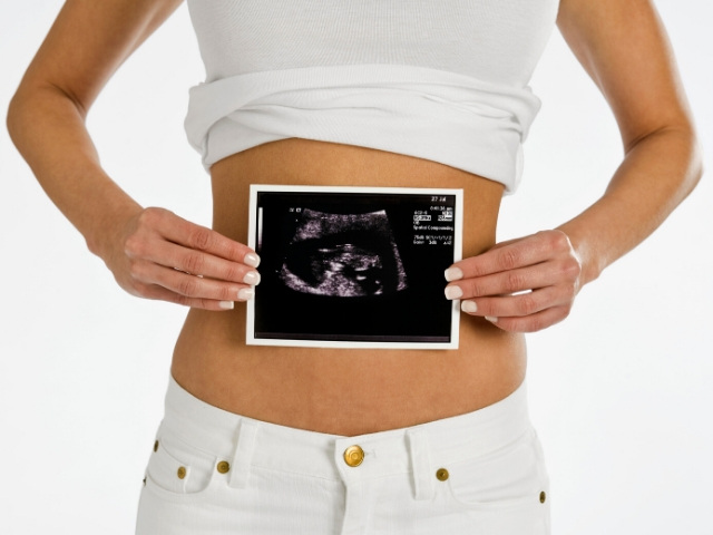 difference between ultrasound and sonogram