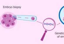 preimplantation genetic diagnosis