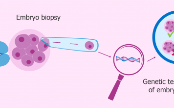 preimplantation genetic diagnosis