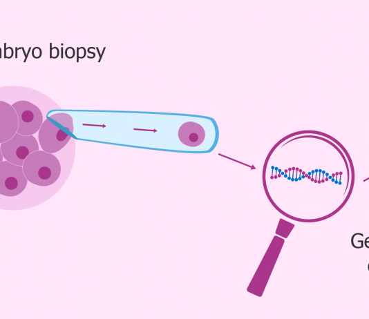 preimplantation genetic diagnosis