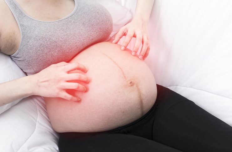 prurigo of pregnancy