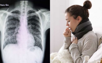 things to know about pneumonia