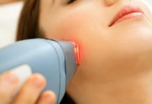 laser treatment for face