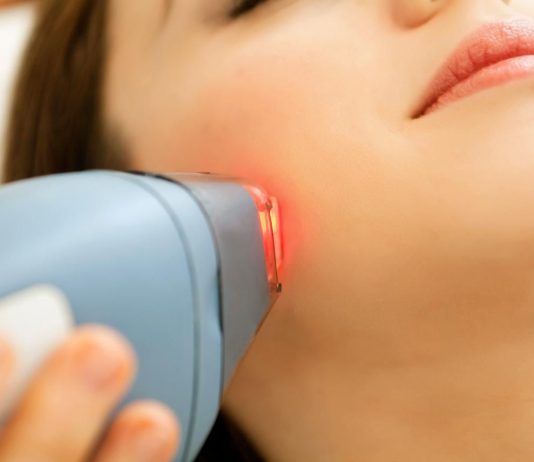 laser treatment for face