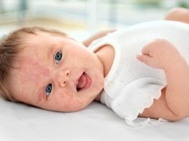 allergic foods for babies