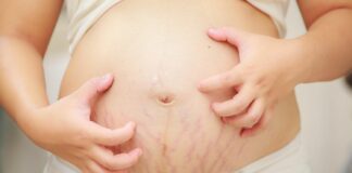 intrahepatic cholestatis of pregnancy