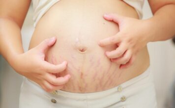 intrahepatic cholestatis of pregnancy