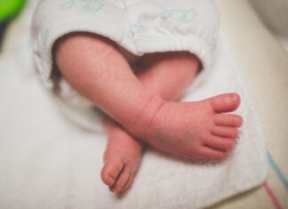 petechiae bleeding in babies