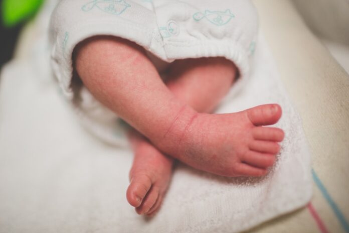 petechiae-bleeding-in-babies-symptoms-treatment-and-prevention