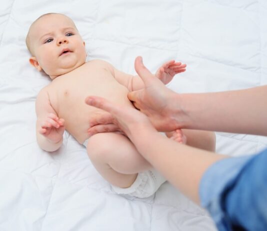 umbilical hernia in babies
